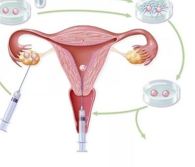 试管冻胚移植成功后前三个月要一直卧床躺着休息吗？